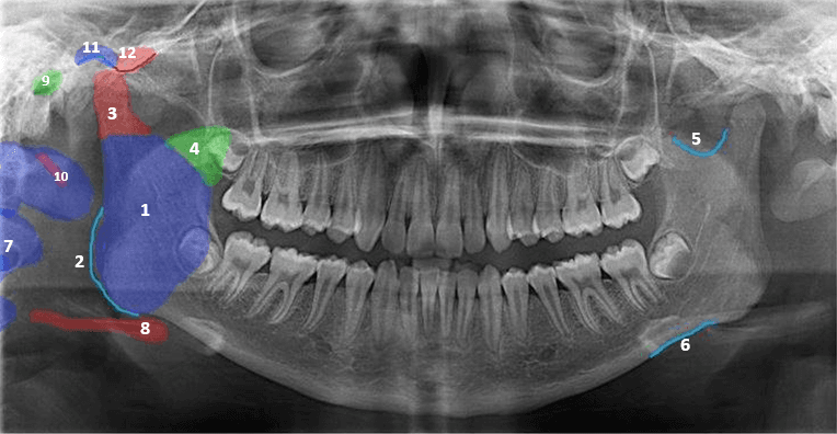 Dental X-Ray Analysis